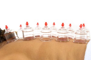 Cupping is een stevige massage die niet erg ontspannen is en zelfs pijnlijk kan zijn ©VINICIUS R TUPINAMBA