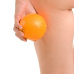 Cellulitis staat ook wel bekend onder de naam sinaasappelhuid ©pershing - Fotolia